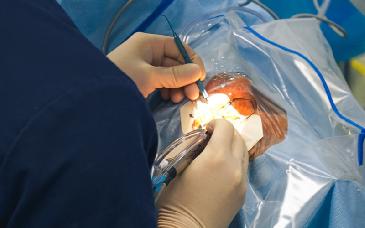 Avanza recuperación de pacientes operados en la Jornada Mirada Clara